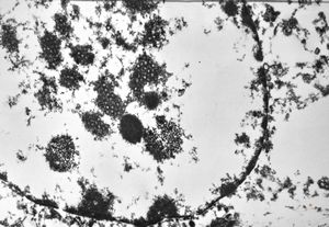 M,11d. | herpes virus, adrenal